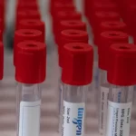 HIV Sc