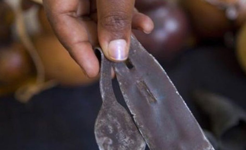 fgm